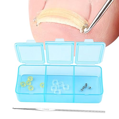 Eingewachsene Zehennägel Werkzeug Set, Gummiring X10 Haken Für Eingewachsene Nägel X5 Häkelnadel X1 Aufbewahrungsbox X1, Tragbarer Zehennagel-Heber, Entwickelt Für Eingewachsene Nägel Reparatur Eingewachsene Zehennägel Werkzeug Set, Gummiring X10 Haken Für Eingewachsene Nägel X5 Häkelnadel X1 Aufbewahrungsbox X1, Tragbarer Zehennagel-Heber, Entwickelt Für Eingewachsene Nägel Reparatur von Generisch