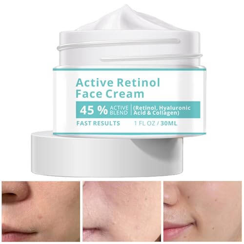 Feuchtigkeitscreme für das Gesicht Frauen, Feuchtigkeitscreme für das Gesicht | Natürliche feuchtigkeitsspendende Gesichtscreme | 30 ml hautweichmachende Creme, feuchtigkeitsspendende Feuchtigkeitscre Feuchtigkeitscreme für das Gesicht Frauen, Feuchtigkeitscreme für das Gesicht | Natürliche feuchtigkeitsspendende Gesichtscreme | 30 ml hautweichmachende Creme, feuchtigkeitsspendende Feuchtigkeitscre von Lyricalist